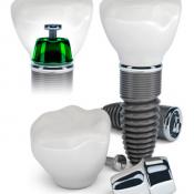 Dental Implants